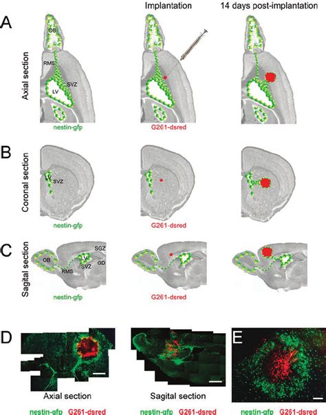 1 Tropism Of NPCs Nestin GFP Positive NPCs Green From The SVZ