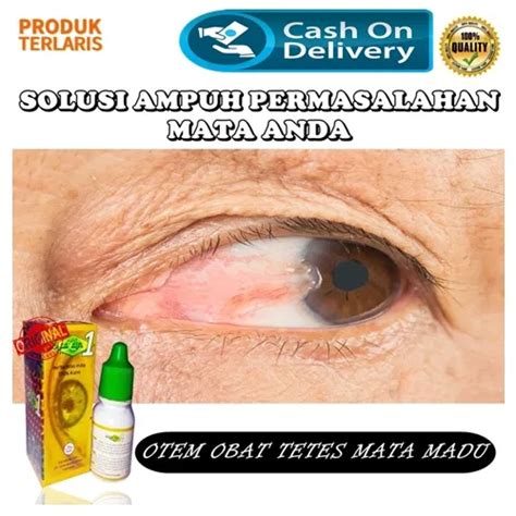 Promo Obat Tetes Mata Katarak Terbaik Membersihkan Selaput Mata