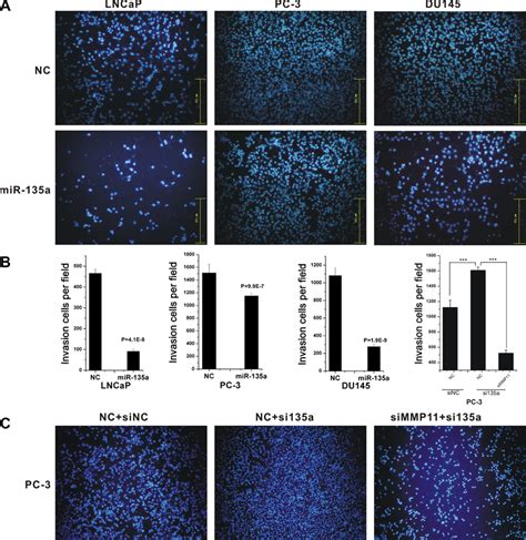 MiR 135a Inhibited Cell Migration And Invasion Migrations Of LNCaP