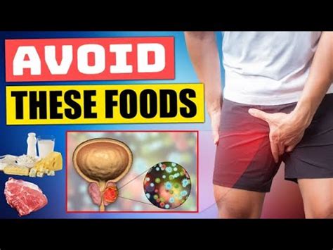 Top 10 Foods To Avoid When You Have An Enlarged Prostate YouTube