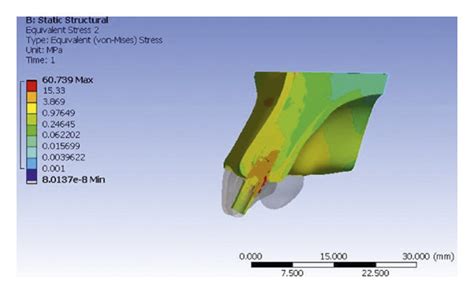 Von Mises Stress In Implant And Peri Implant Bone For Straight And Download Scientific Diagram