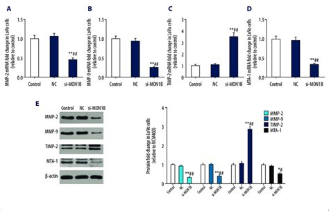 Mon1b Interference Inhibited Cell Migration And Invasion Abilities Of