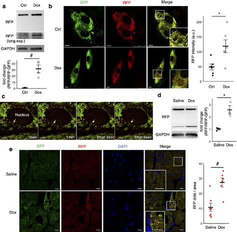 Figure From Endoplasmic Reticulum Selective Autophagy Alleviates