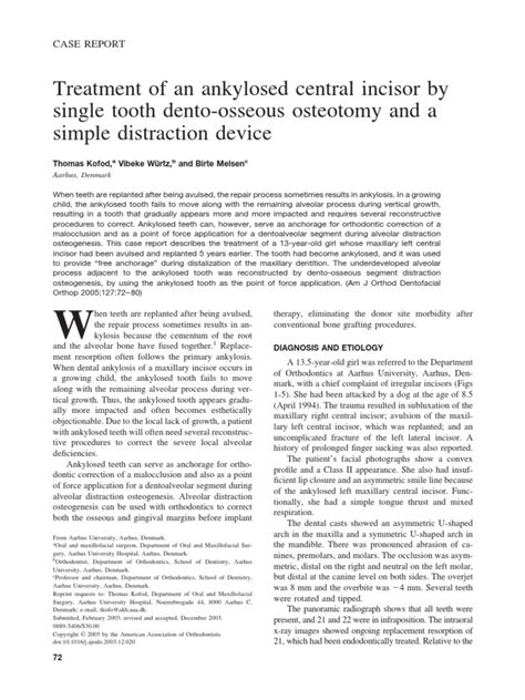 Treatment Of An Ankylosed Central Incisor By Single Tooth Dento Osseous Osteotomy And A Simple