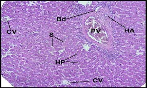 Histological Section Of The Liver In Mallard Duck Showing The Portal