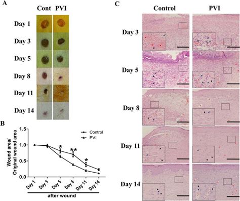 Povidone Iodine PVI Treatment Enhanced Cutaneous Wound Closure And