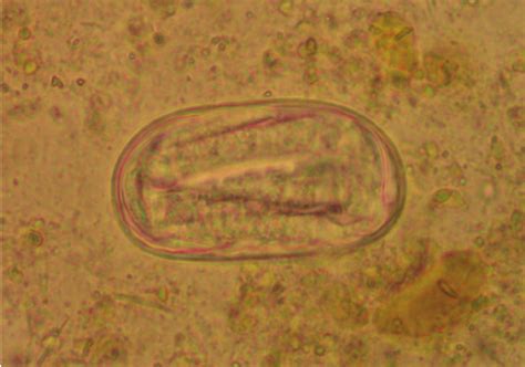 Enterobius Vermicularis Egg With Larva Download Scientific Diagram