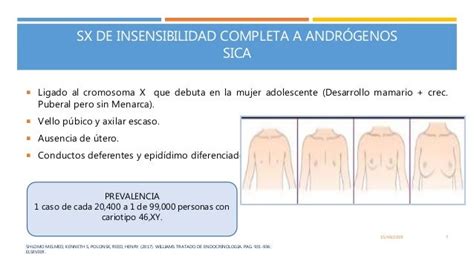 SÍndrome De Insensibilidad A Los AndrÓgenos Genetica