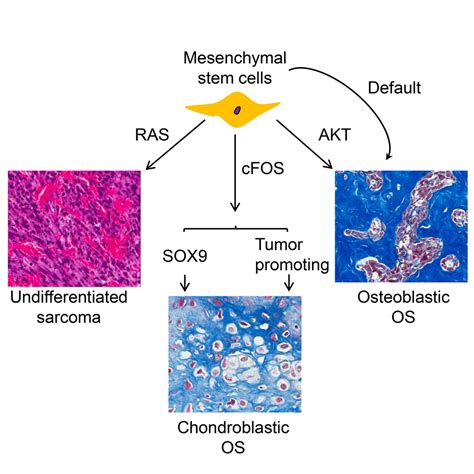 CFOS SOX9 Axis Reprograms Bone Marrow Derived Mesenchymal Stem Cells