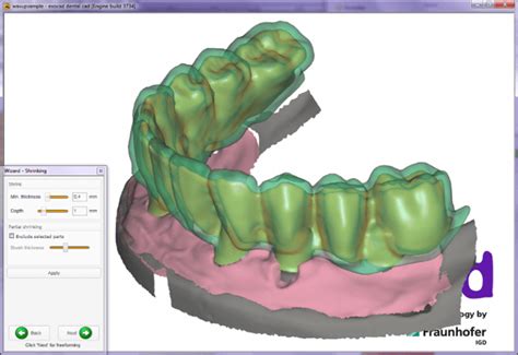 Exocad For Technicians Dental Cad Website