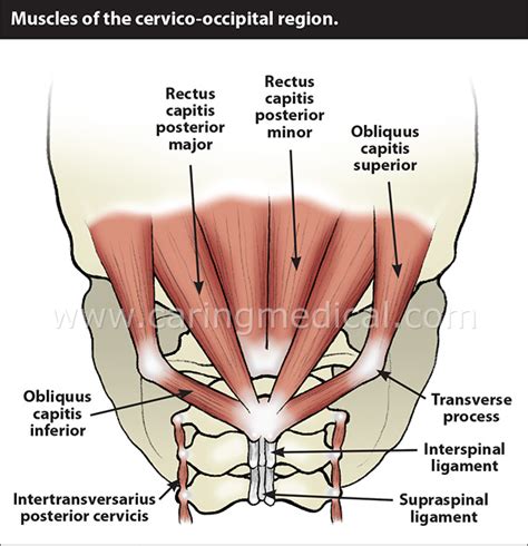 Occipital Nerves Diagram