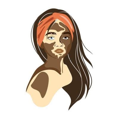 Vitiligo Vector Art, Icons, and Graphics for Free Download