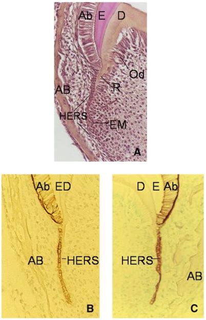 Open Access Nfic Gene Disruption Inhibits Differentiation Of