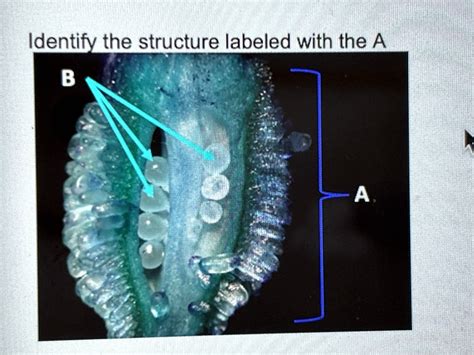 Solved Identify The Structure Labeled With The A Ldentify The