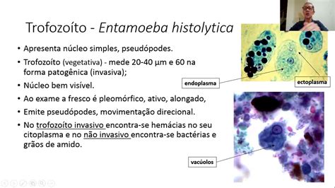 12 Aula PrÁtica 1 Entamoeba Histolytica Morfologia Patogenias E Diagnóstico Youtube