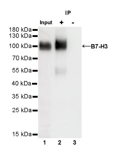 B7 H3 Recombinant Rabbit Mab Sdt 249 26q5zpr3starter Bio