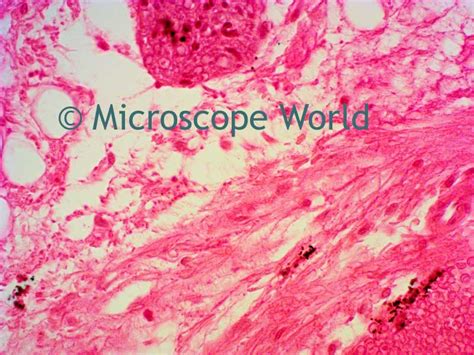 Microscope World Blog: Optic Nerve Under the Microscope