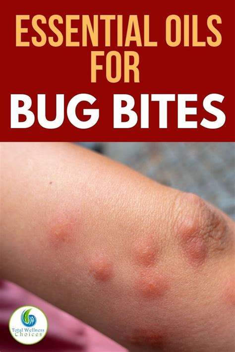 Top 7 Essential Oils For Bug Bites Essential Oils For Mosquitoes Essential Oils Bug Bites