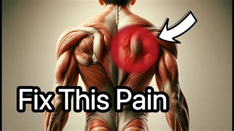 Fix Upper Back Pain Get Rid Of Rhomboid Pain YouTube