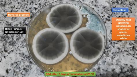 Cladosporium And Penicillium Growth On SDA And Their LPCB Mount