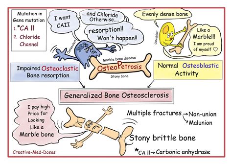 Osteopetrosis cartoons and illustrations - Creative Med Doses