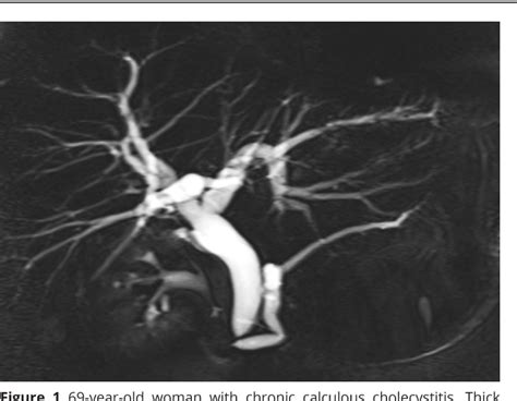 Figure From Mri System Scoring For Differentiation Of Malignant