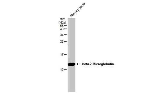 Beta 2 Microglobulin Polyclonal Antibody Pa5 29580