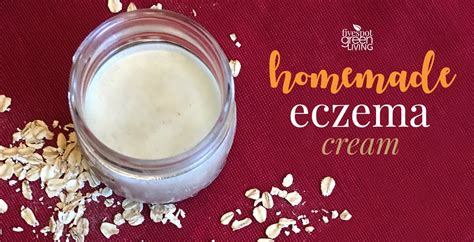 Homemade Eczema Cream Recipe for Dry Winter Skin - Five Spot Green Living