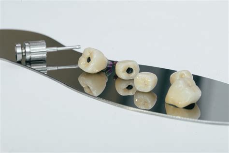 Prosthesis – Dental Planet