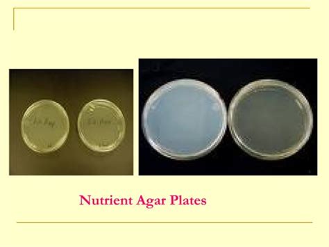 Bacterial Culture media | PPT