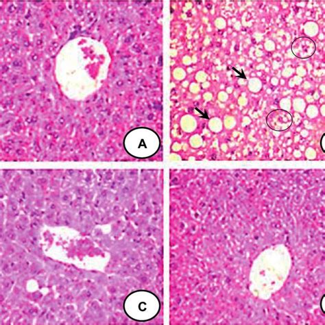 Representative Liver Sections Stained With Hematoxylin And Eosin 40Â Download Scientific