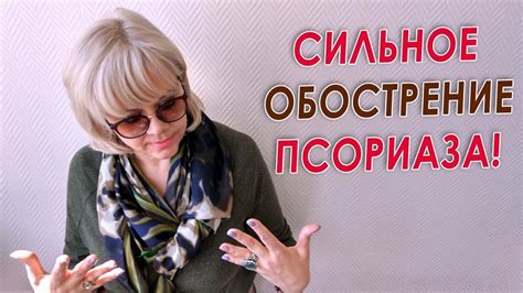 Обострение ПСОРИАЗА - YouTube