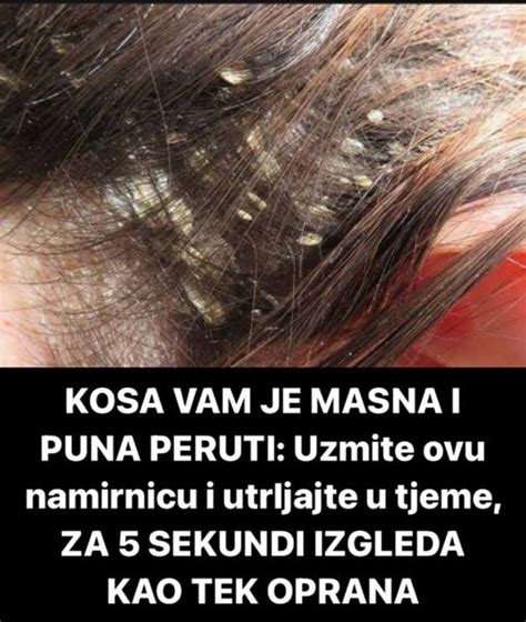 Kosa Vam Je Masna I Puna Peruti Uzmite Ovu Namirnicu I Utrljajte U