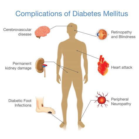 The Facts About Diabetes Lifestyle Medical Centers