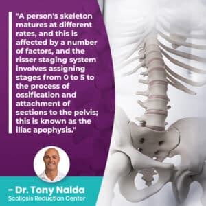 The Risser Stages Classification & Scoliosis Surgery