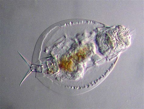 Beyond The Human Eye Another Rotifer