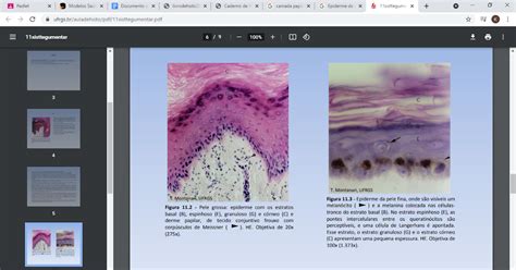 Blog De Histologia Veterin Ria Derme Epiderme Hipoderme Anexos