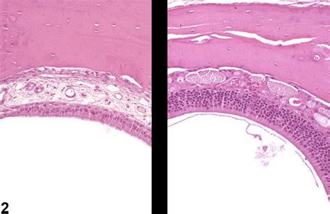 Nose Olfactory Epithelium Metaplasia Respiratory Nonneoplastic Lesion Atlas