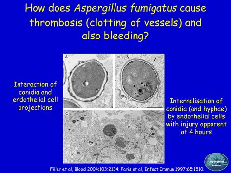 Ppt The Extraordinary Spectrum Of Diseases Caused By Aspergillus Powerpoint Presentation Id