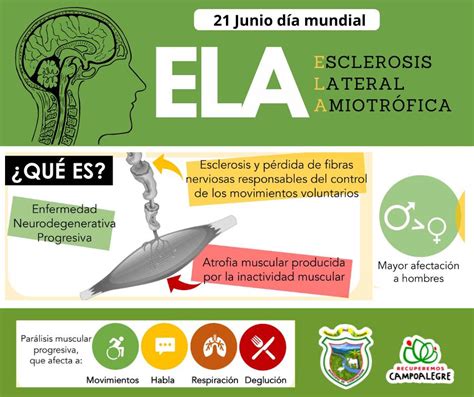 21 de Junio Día Mundial de la Esclerosis Lateral Amiotrófica