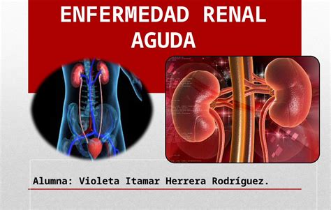 PPTX INSUFICIENCIA RENAL AGUDA DOKUMEN TIPS