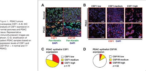 Figure 1 From CSF1 CSF1R Blockade Reprograms Tumor Infiltrating