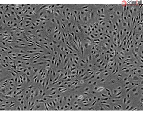 Human Brain Microvascular Endothelial Cells HBMEC