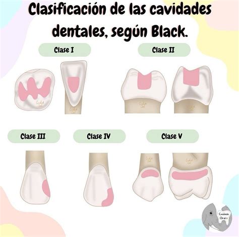 The Different Types Of Dentals Are Shown In This Graphic Above It S