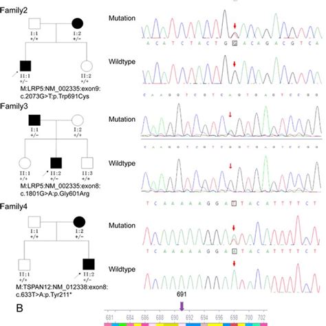 Structure Comparisons Between Wildtype And Two Mutant LRP5 Proteins In