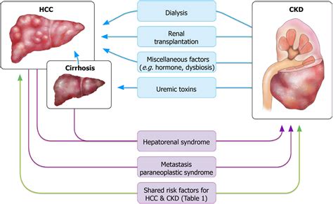 Pathophysiology Of Hepatocellular Carcinoma