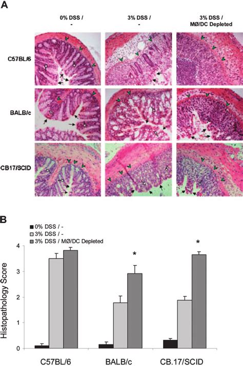 Colon Pathology Shows Enhanced Injury In M Dc Depleted Dss Colitis