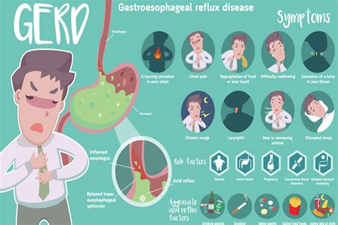 GERD: Causes, Symptoms & Treatment Options