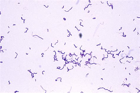 Bacillus Sp