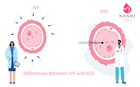 Understanding The Differences Between Ivf And Icsi